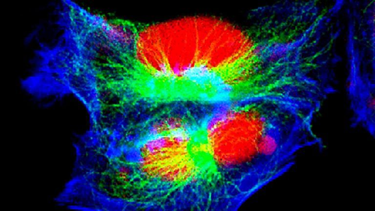 Neuroblastoma-Gejala-dan-Pneyebabnya