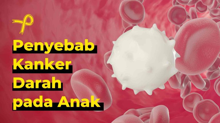 Penyebab-Kanker-Darah-pada-Anak