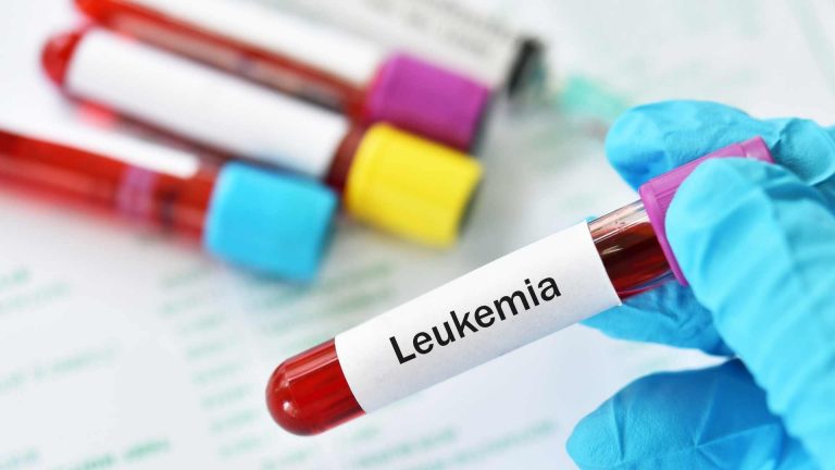 Perbedaan Leukemia ALL dan AML