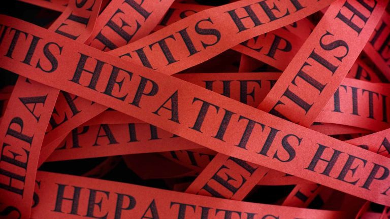 Hepatitis Akut pada Anak