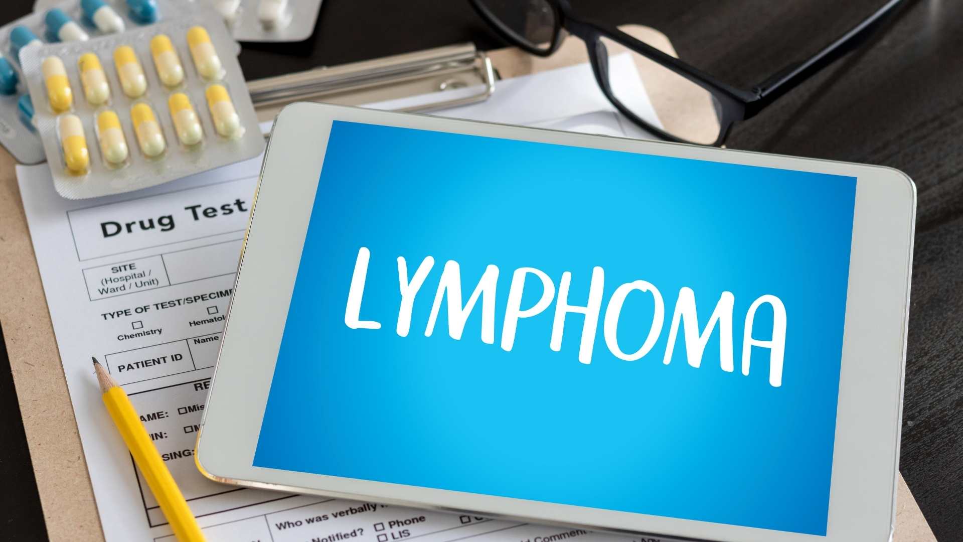 Limfoma Burkitt - Gejala dan Penangannya