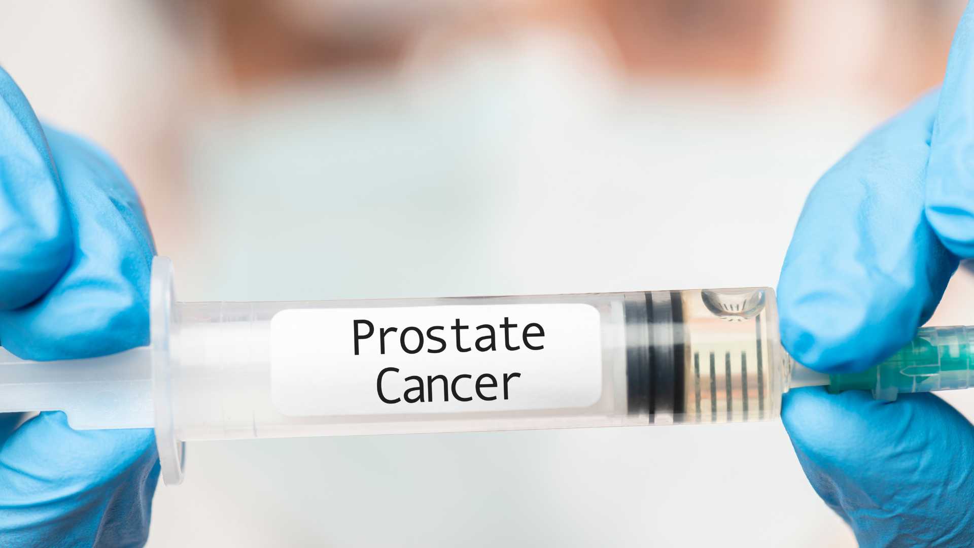 Kanker Prostat – Penyebab, Gejala, Cara Mencegah