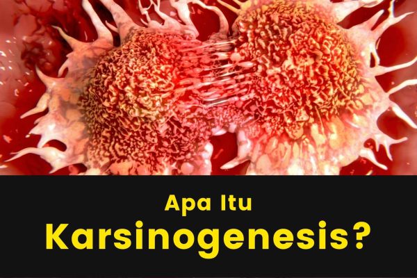 Apa-Itu-Karsinogenesis