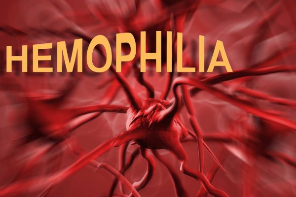Hemofilia