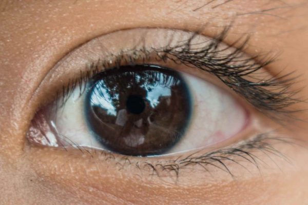 Kanker-Mata-pada-Anak-Retinoblastoma