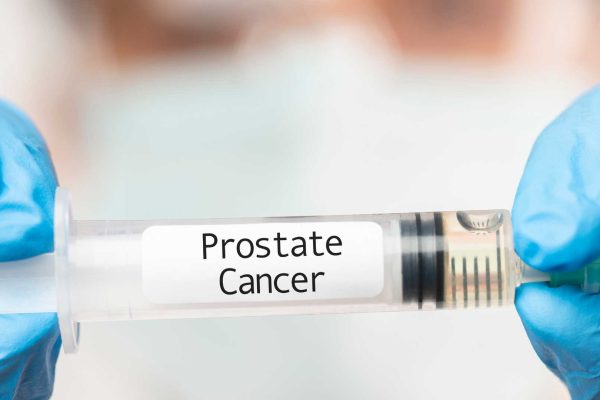 Kanker Prostat