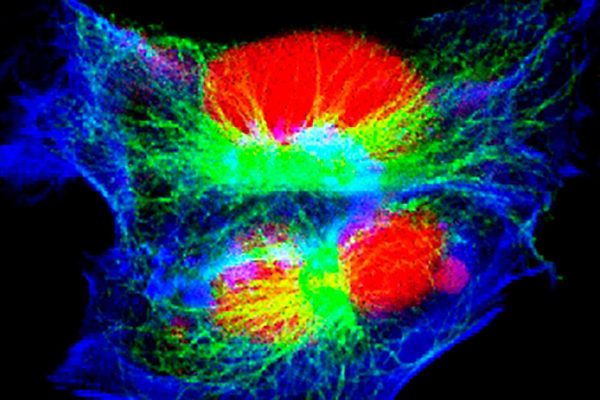 Neuroblastoma-Gejala-dan-Pneyebabnya