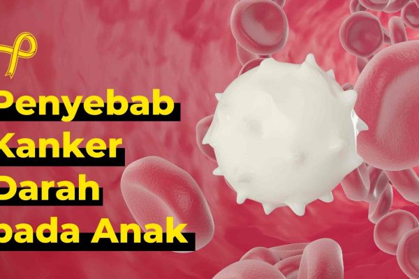 Penyebab-Kanker-Darah-pada-Anak