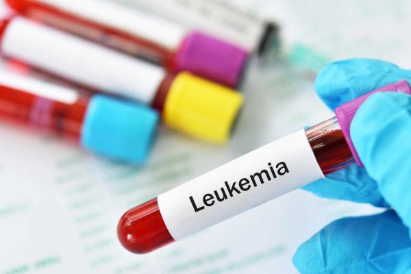Perbedaan Leukemia ALL dan AML